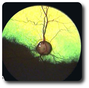 fundus1