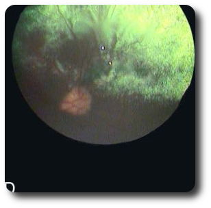 fundus4